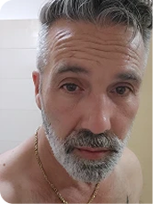 Antes